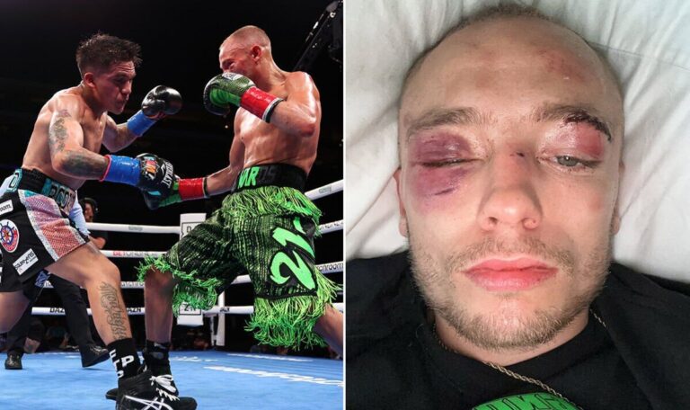 Boxer Sunny Edwards barely recognisable after suffering sickening eye injury in title tilt | Boxing | Sport