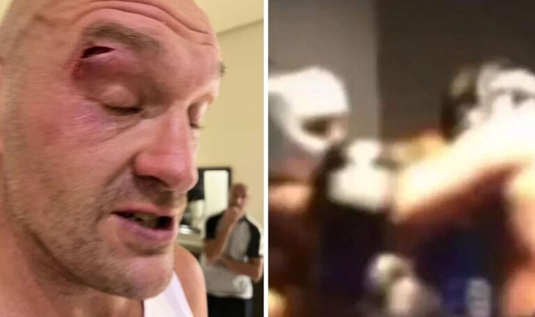 Boxer who cut Tyson Fury breaks silence after elbowing Gypsy King – EXCLUSIVE | Boxing | Sport